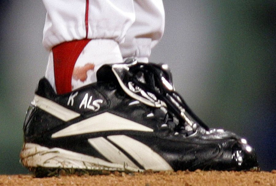 The torn tendon sheath in Curt Schillings right ankle bleeds through his sock during game 6. Schillings pitched through this and had one of the most memorable games in postseason history.